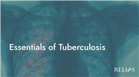 Essentials of Tuberculosis