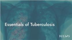 Essentials of Tuberculosis